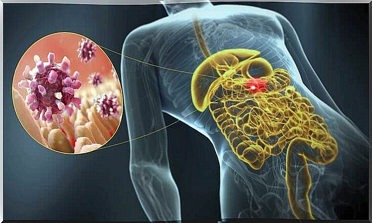 removal of intestinal parasites