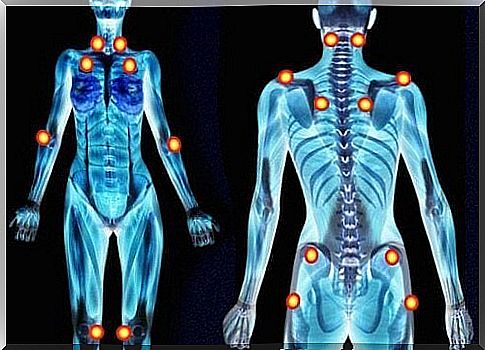 5 warning signs during fibromyalgia