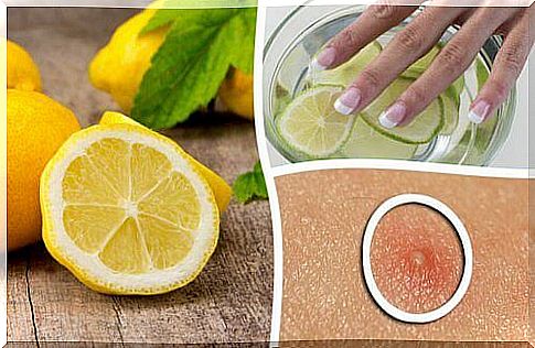 6 ways to use lemon in beauty care