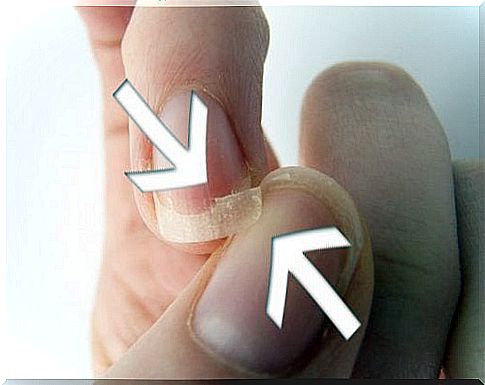 warning signs given by the nails include e.g.  split nails