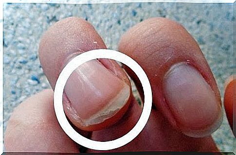 nail scaling is a warning sign given by the nail