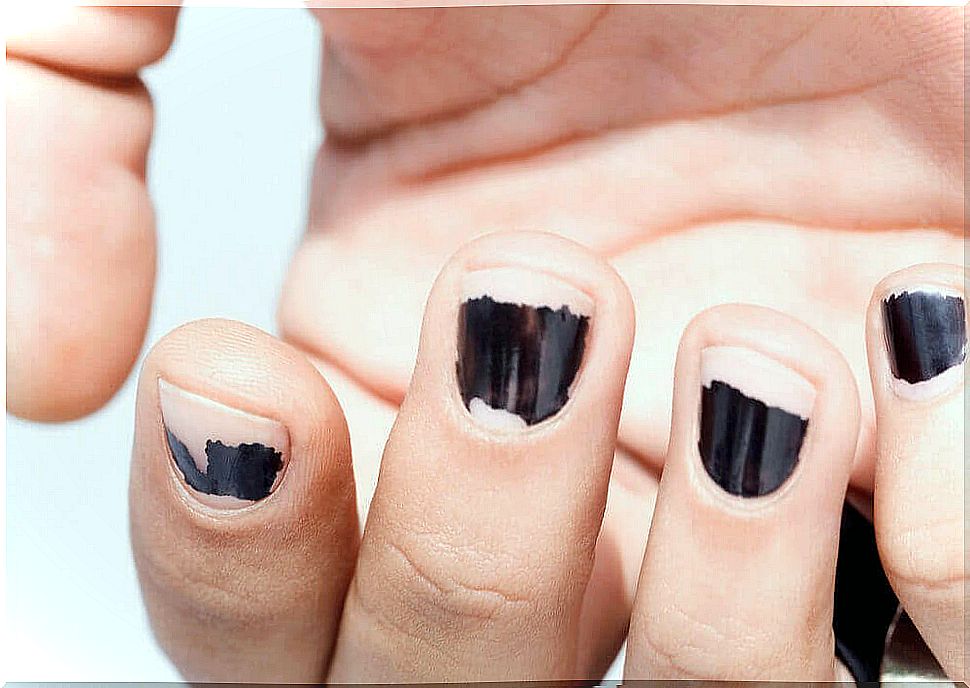 the removal of nail polish affects the brittleness of the nails