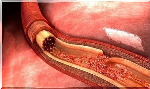 Aortic rupture: what it is and what it causes