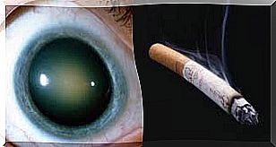 cataracts and smoking