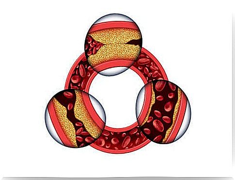 Cholesterol control in women