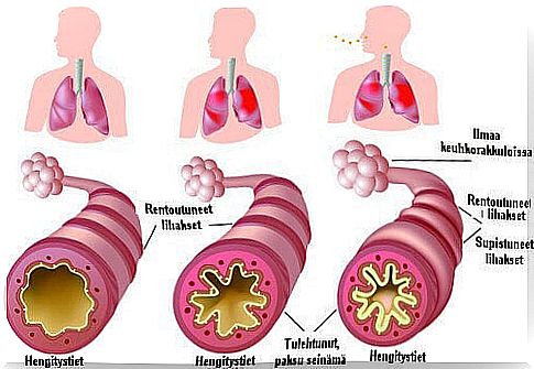 Chronic asthma and allergies - what's the help?