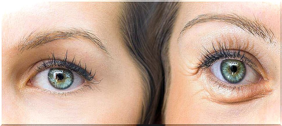 Firms drooping eyelids with these five natural ingredients