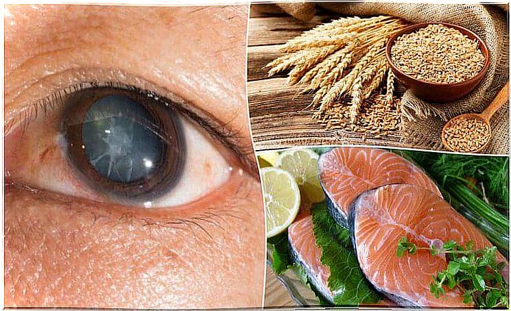 Prevent cataracts with these 7 foods