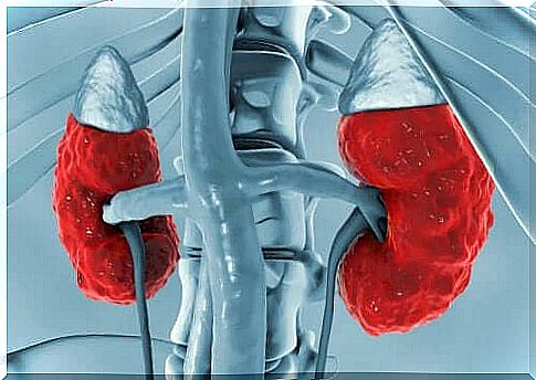 Renal hyperchloraemic acidosis causes, for example, hyperventilation, fatigue, and confusion in the patient, and in the worst case, even a state of shock that can be fatal.