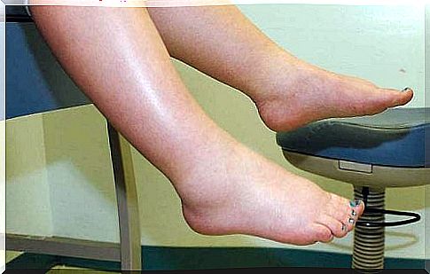 prevent swelling in the legs